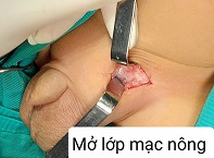 Mở lớp mạch nông/benhhocnam.com