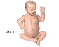 http://sdvworkshop.net/images/mp-bs-tlnk-patenturachus3.png
